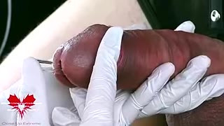 Perfect Extraction Of Sperm Directly From The Urethra. Close-up Of The Glass Straw Sounding